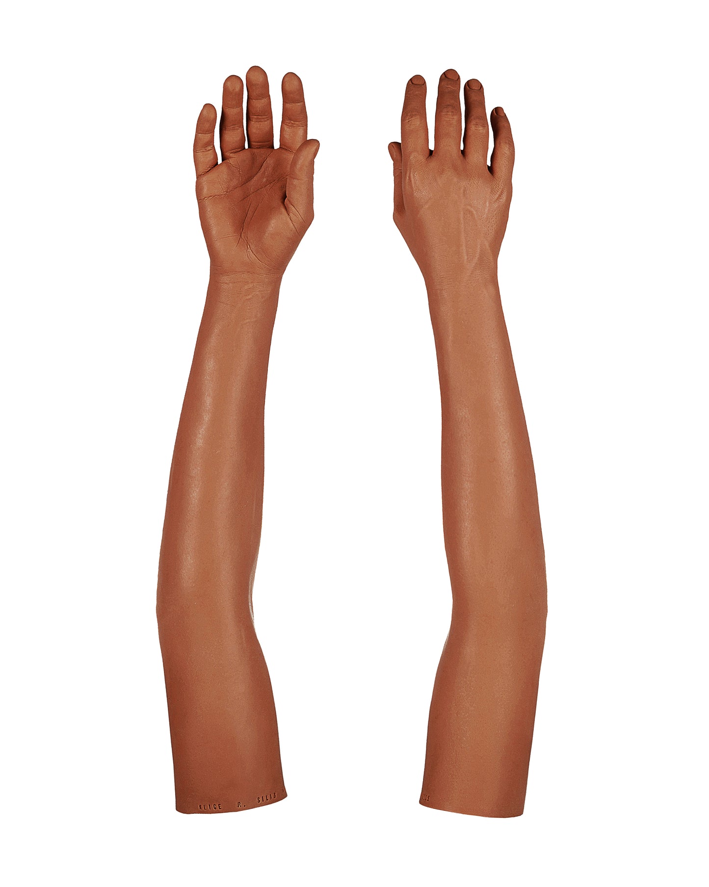 Cosmetic Prosthetic Glove – Women Shape / Arm / Ref. "Alice"