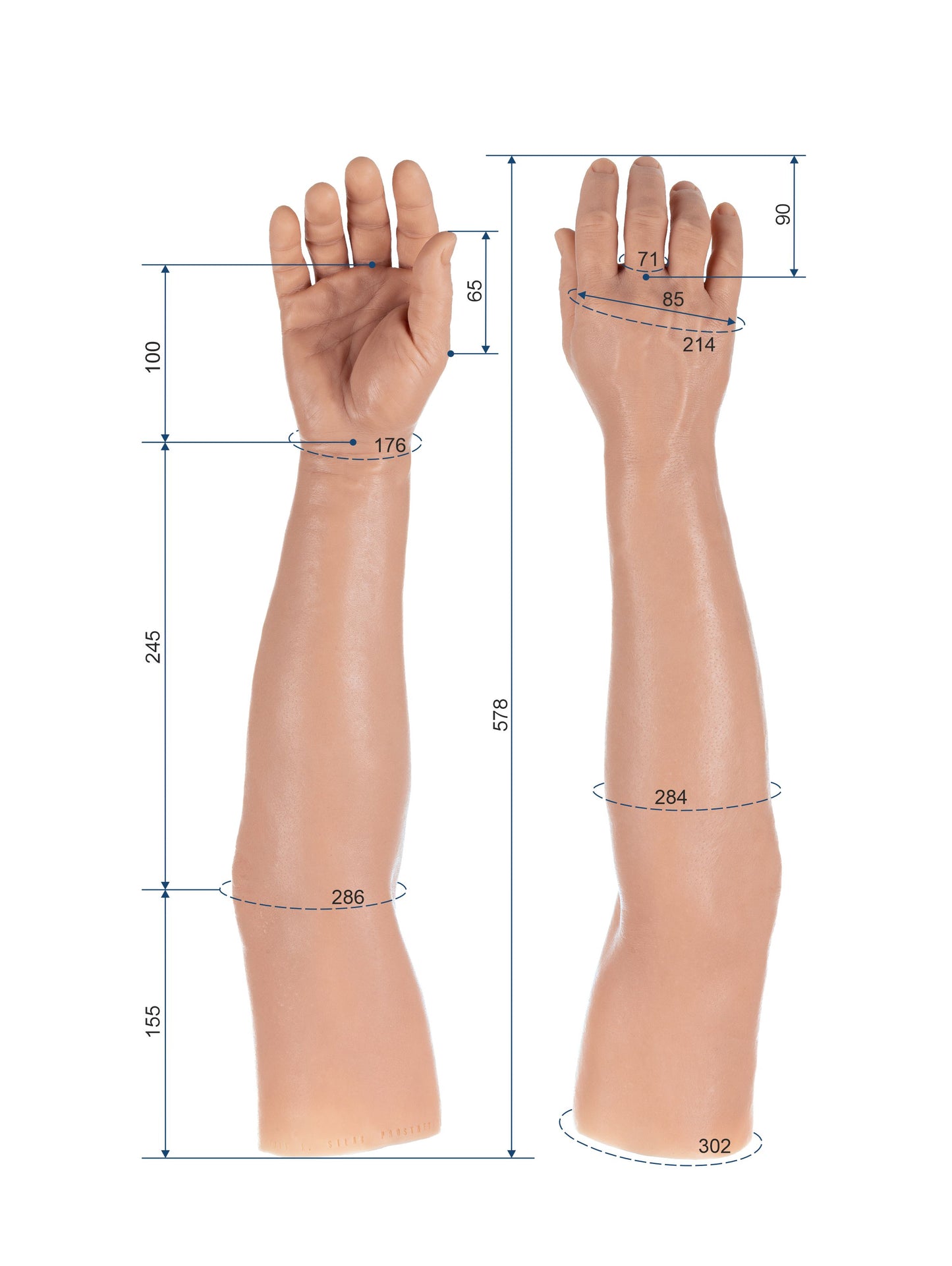 Cosmetic Prosthetic Glove – Men Shape / Arm / Ref. "Gary"