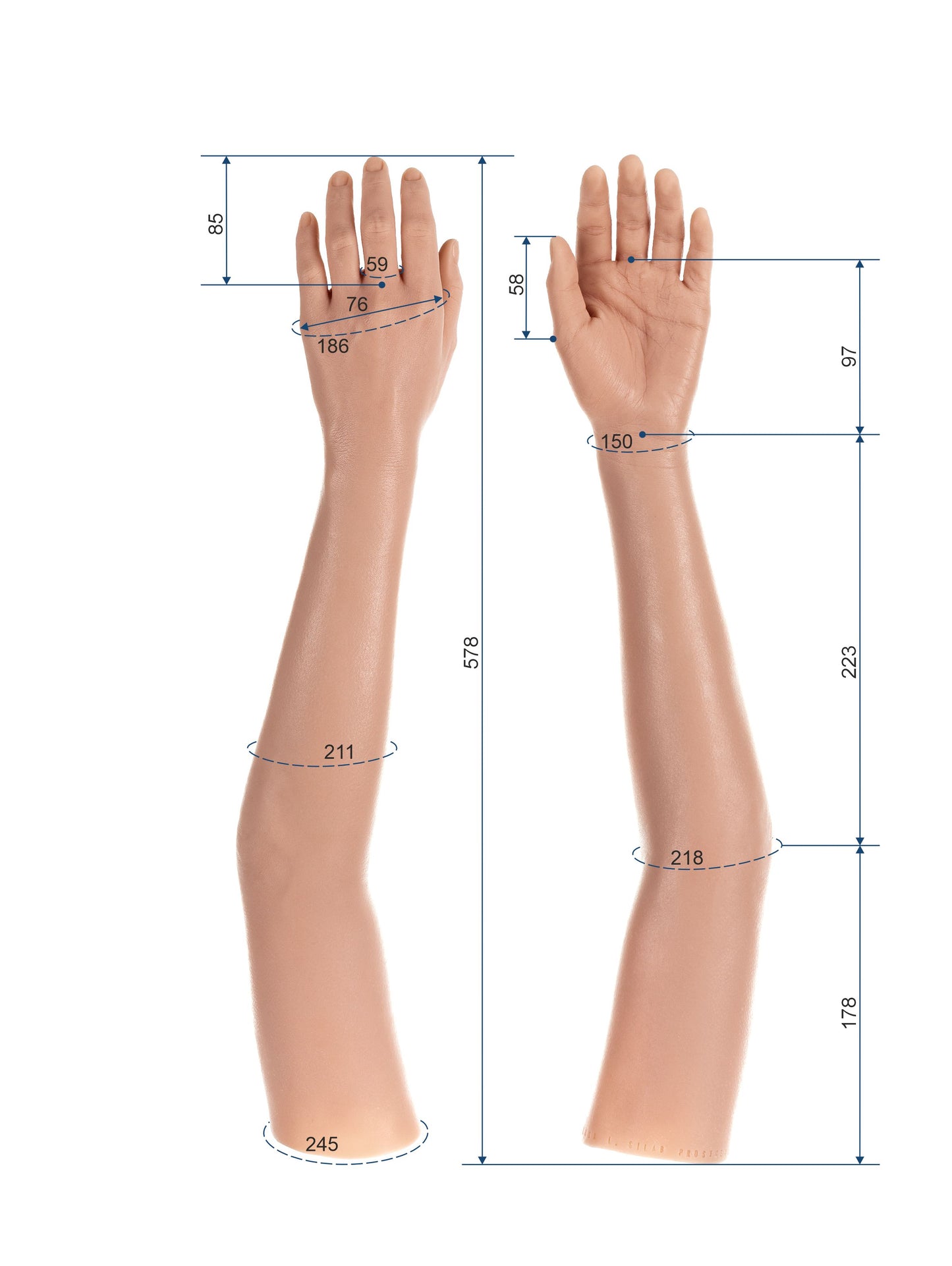 Cosmetic Prosthetic Glove – Women Shape / Arm / Ref. "Lisa"