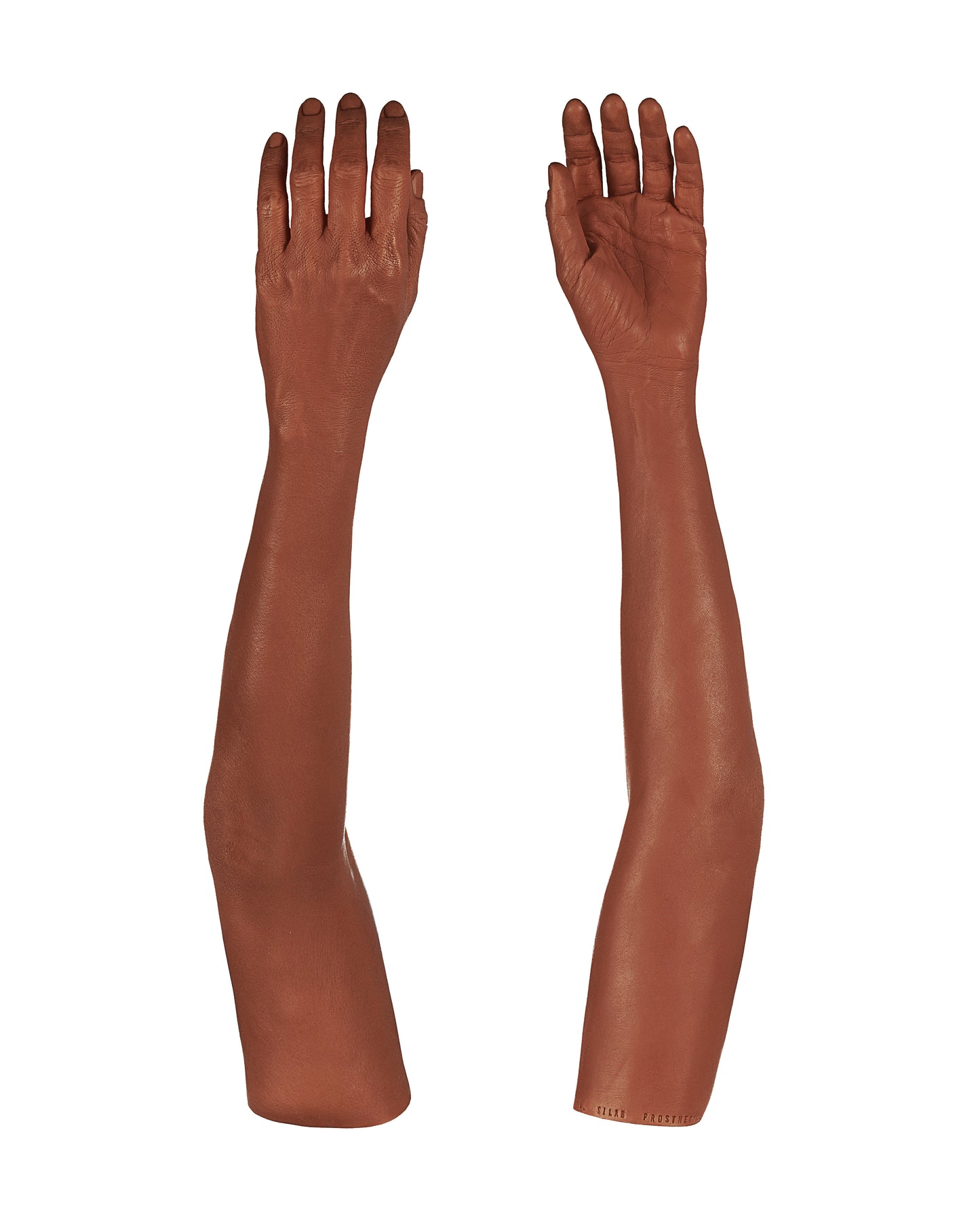 Cosmetic Prosthetic Glove – Women Shape / Arm / Ref. "Sandra"