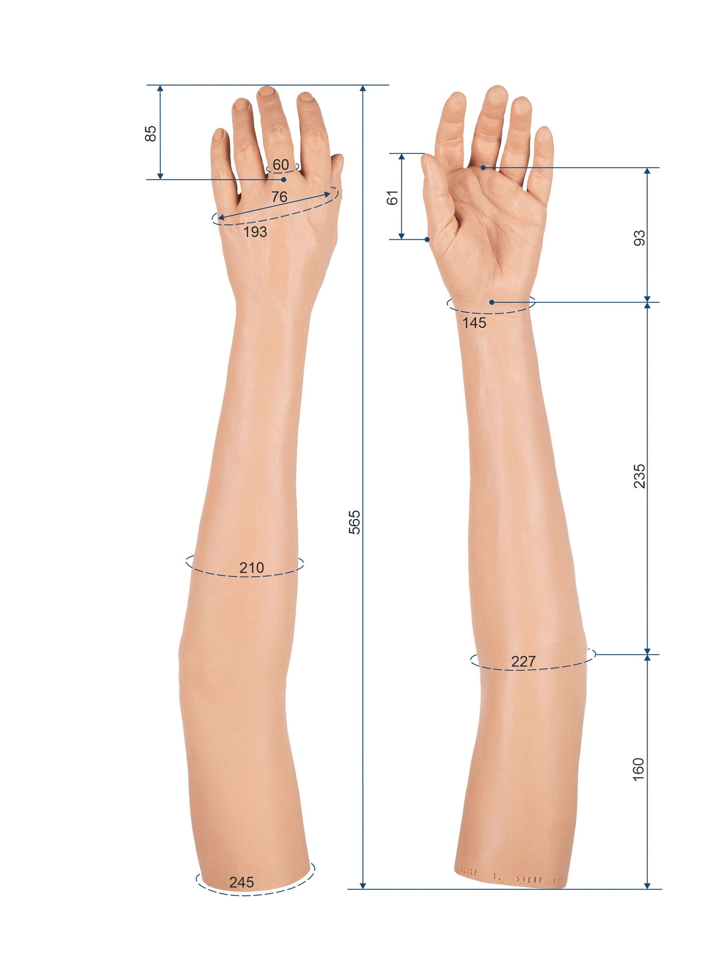 Cosmetic Prosthetic Glove – Women Shape / Arm / Ref. "Alice"