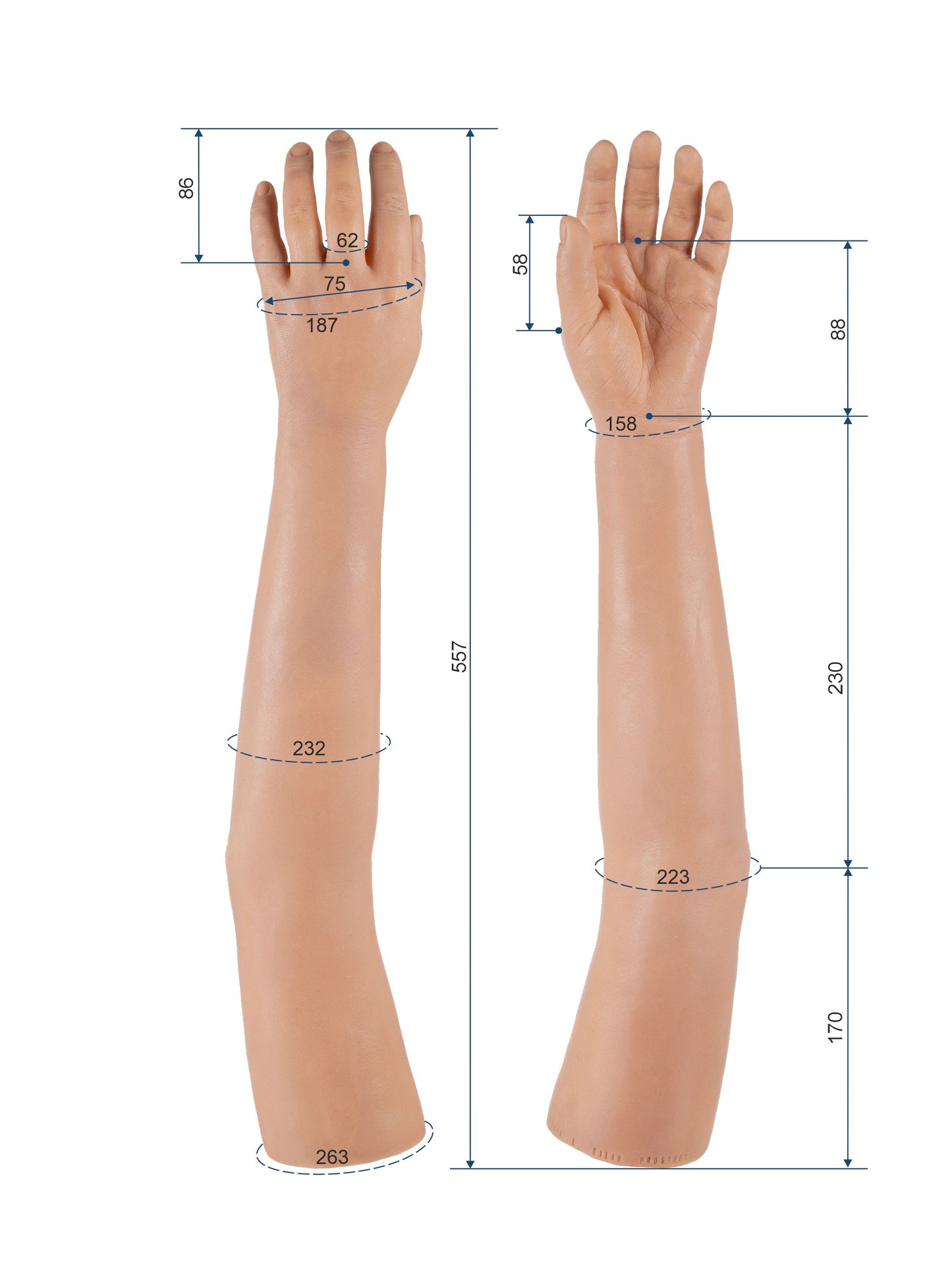 Cosmetic Prosthetic Glove – Women Shape / Arm / Ref. "Anna"