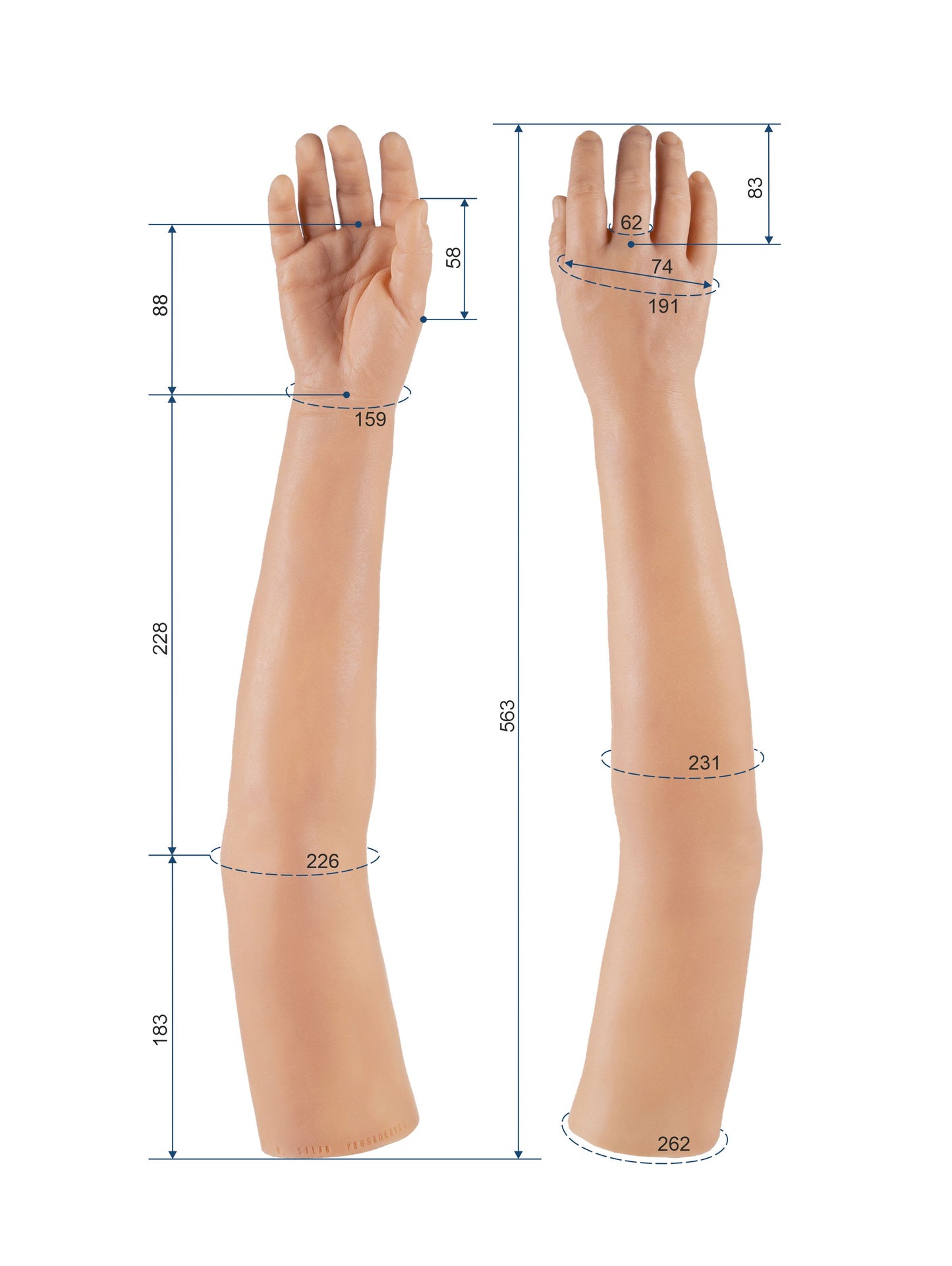 Cosmetic Prosthetic Glove – Women Shape / Arm / Ref. "Anna"