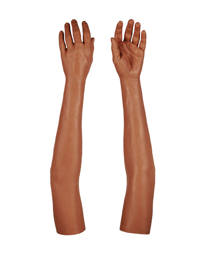 Cosmetic Prosthetic Glove – Women Shape / Arm / Ref. "Alice"
