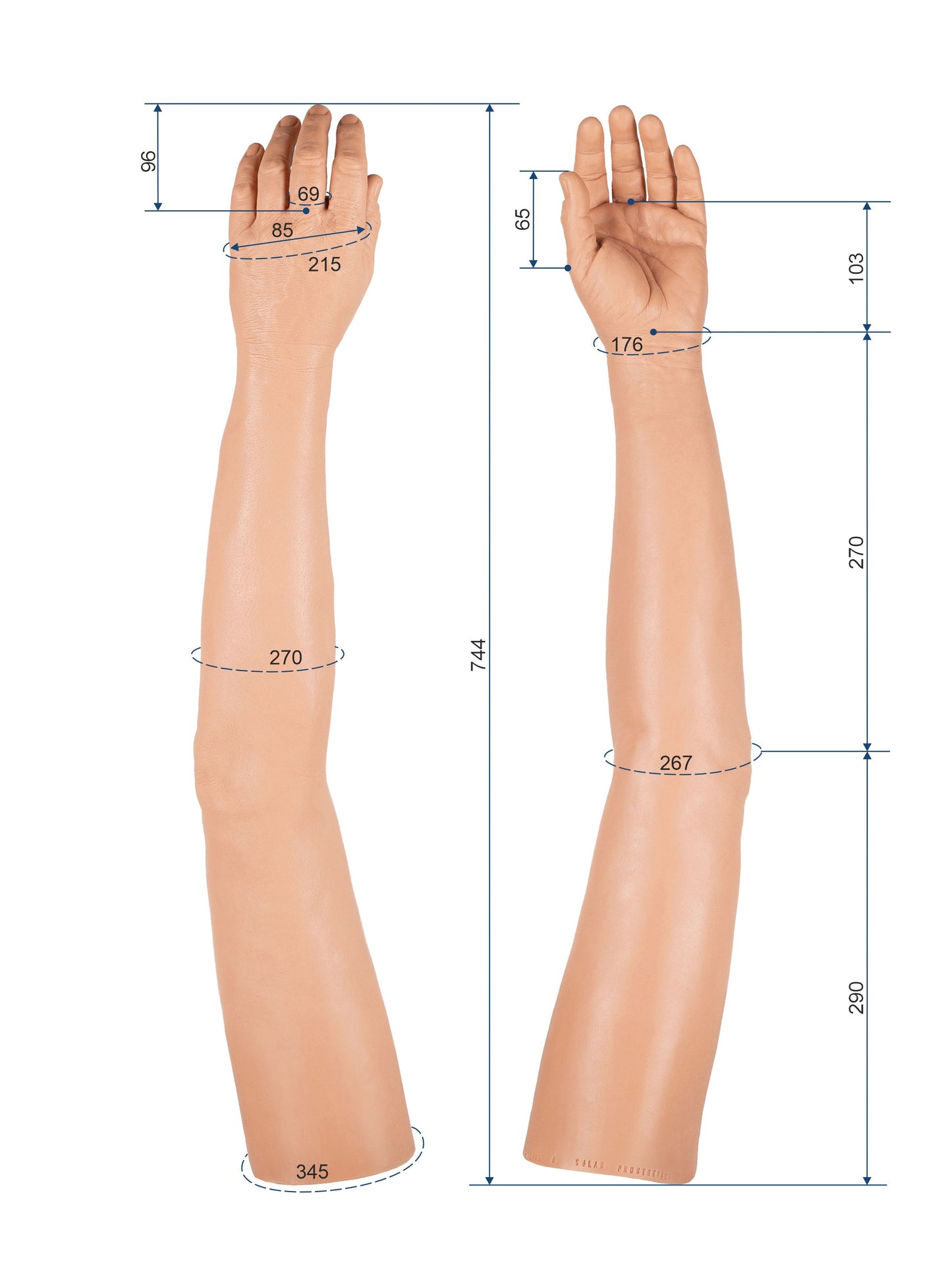 Cosmetic Prosthetic Glove –  Men Shape / Arm / Ref. "Michel"