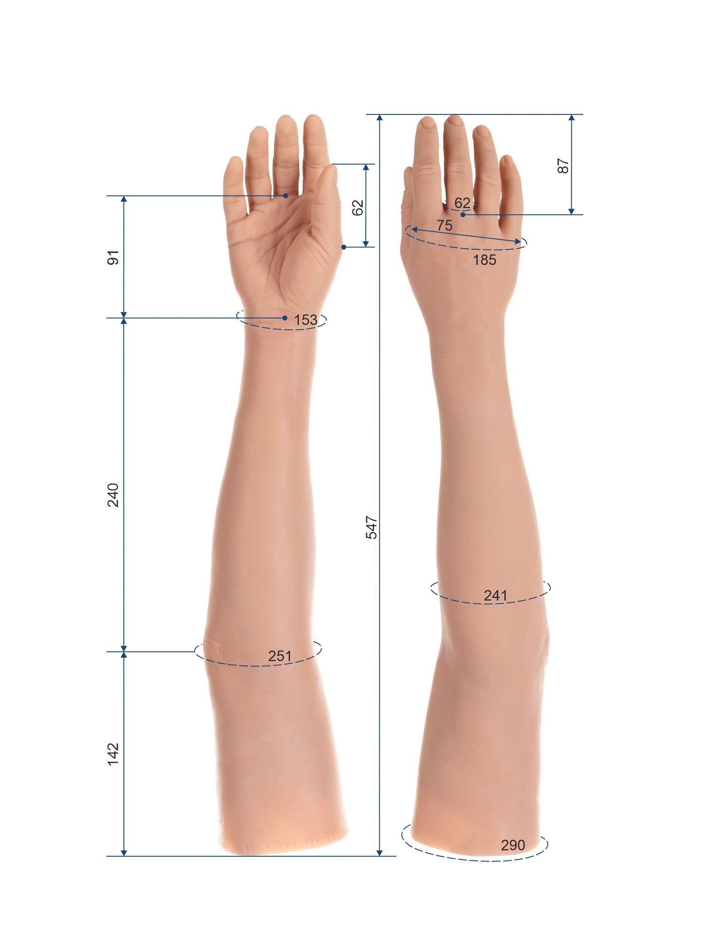 Cosmetic Prosthetic Glove – Women Shape / Arm / Ref. "Ira"